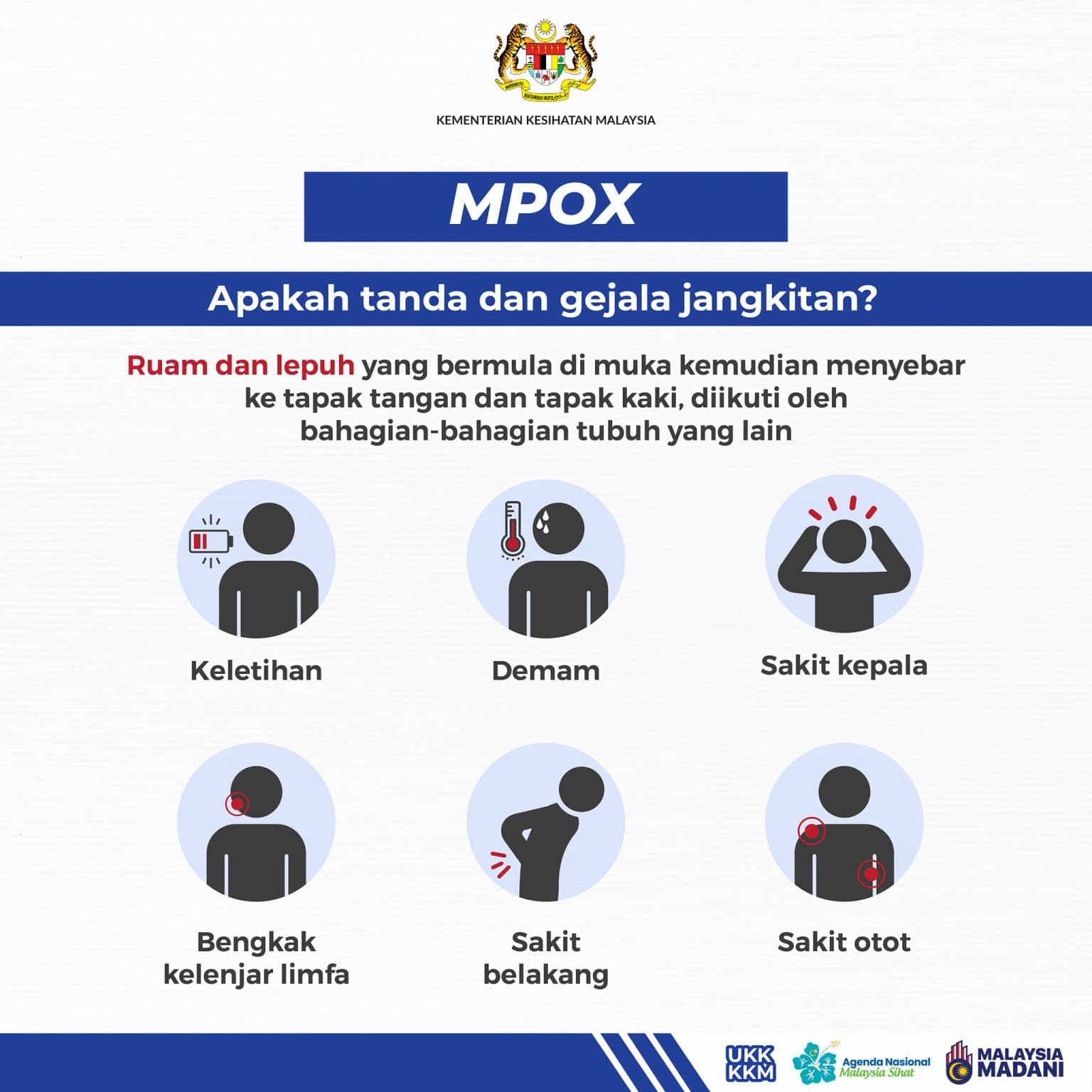 Tanda Dan Gejala Cacar Monyet